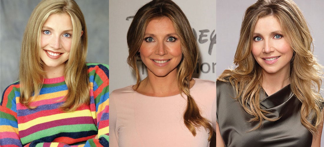Sarah Chalke Plastic Surgery Before and After 2022