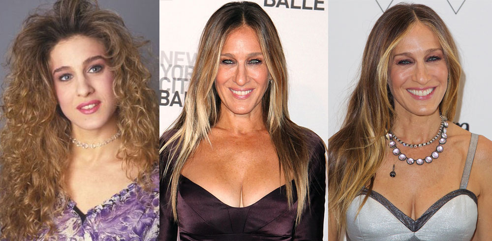 Sarah Jessica Parker Plastic Surgery Before and After 2023