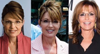 Sarah Palin Plastic Surgery