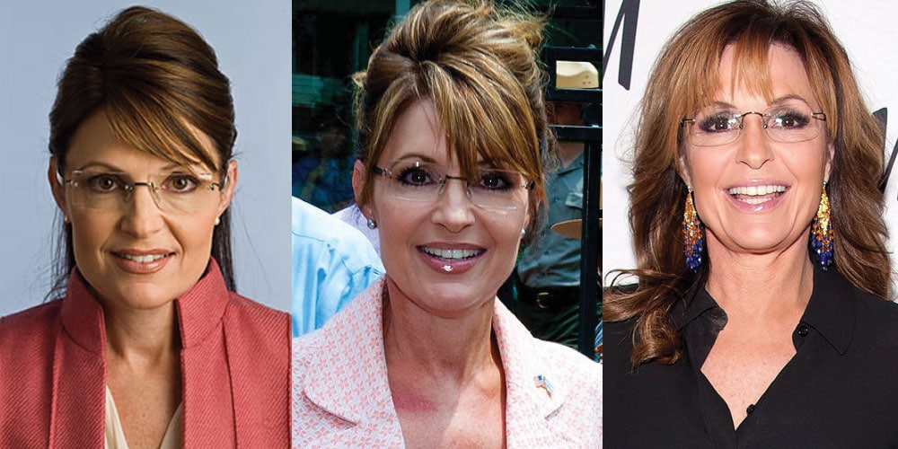 Sarah Palin Plastic Surgery Before and After 2022