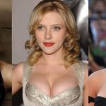 Scarlett Johansson Plastic Surgery