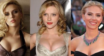 Scarlett Johansson Plastic Surgery