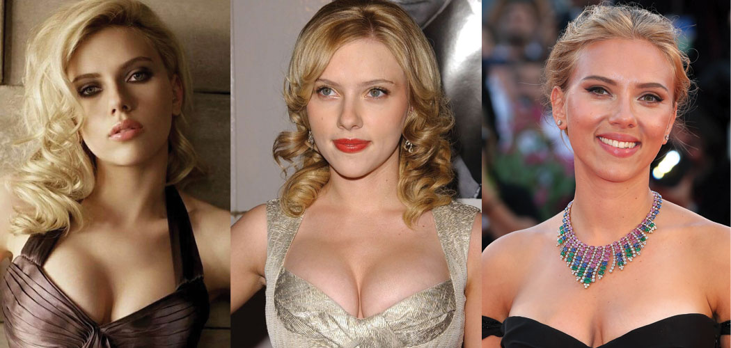 Scarlett Johansson Plastic Surgery Before and After 2023