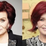 Sharon Osbourne Plastic Surgery