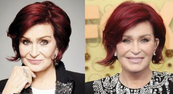 Sharon Osbourne Plastic Surgery