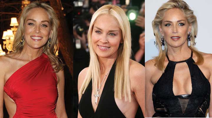 sharon stone plastic surgery