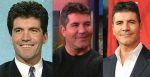 Simon Cowell Plastic Surgery