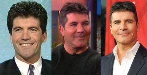 simon cowell plastic surgery