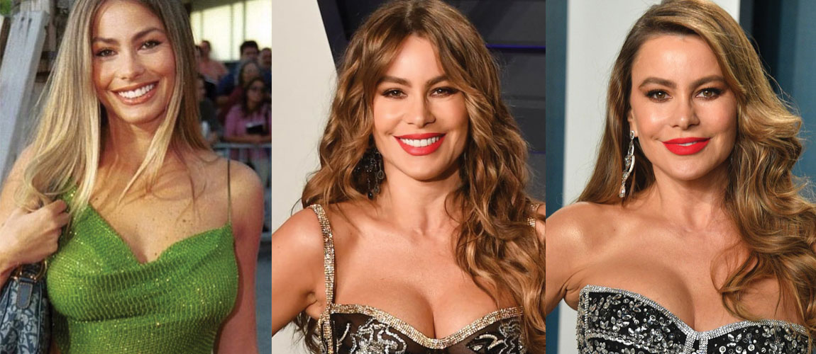 Sofia Vergara Plastic Surgery Before and After 2022