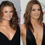 Stana Katic Plastic Surgery