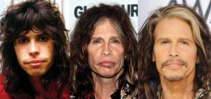 steven tyler plastic surgery