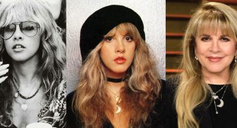 Stevie Nicks Plastic Surgery