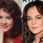 Stockard Channing Plastic Surgery