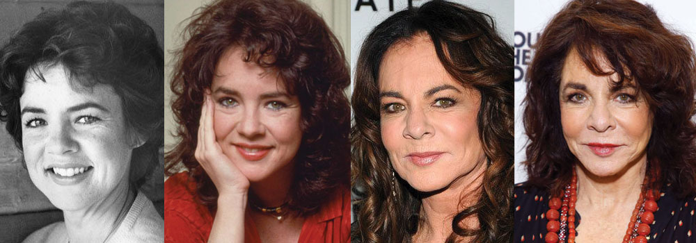 Stockard Channing Plastic Surgery Before and After 2024
