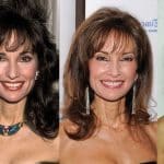 Susan Lucci Plastic Surgery