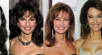 Susan Lucci Plastic Surgery
