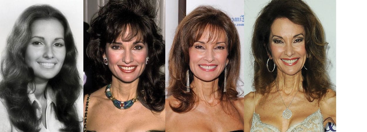 Susan Lucci Plastic Surgery Before and After 2023