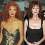 Susan Sarandon Plastic Surgery