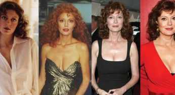 Susan Sarandon Plastic Surgery