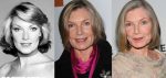 Susan Sullivan Plastic Surgery