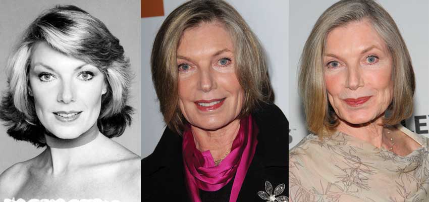 Susan Sullivan Plastic Surgery Before and After 2022