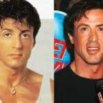 Sylvester Stallone Plastic Surgery