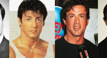 Sylvester Stallone Plastic Surgery