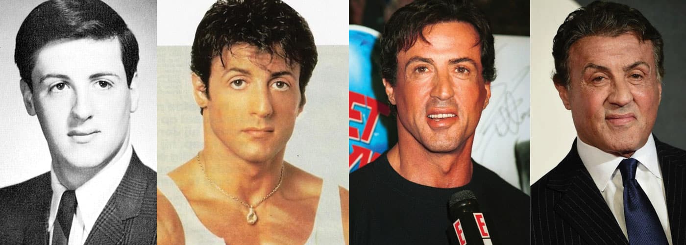 Sylvester Stallone Plastic Surgery Before and After 2023