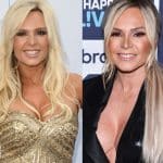 Tamra Barney Plastic Surgery