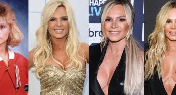 Tamra Barney Plastic Surgery