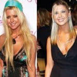 Tara Reid Plastic Surgery