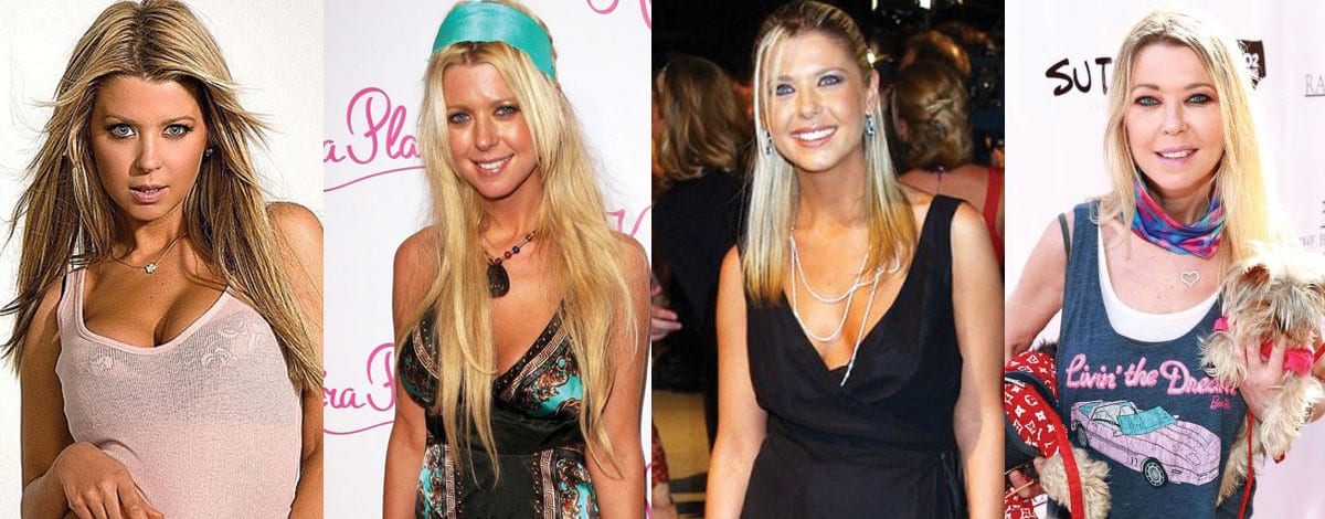 Tara Reid Plastic Surgery Before and After 2023