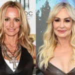 Taylor Armstrong Plastic Surgery