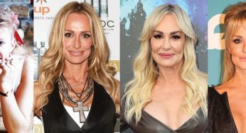 Taylor Armstrong Plastic Surgery