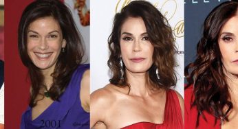 Teri Hatcher Plastic Surgery