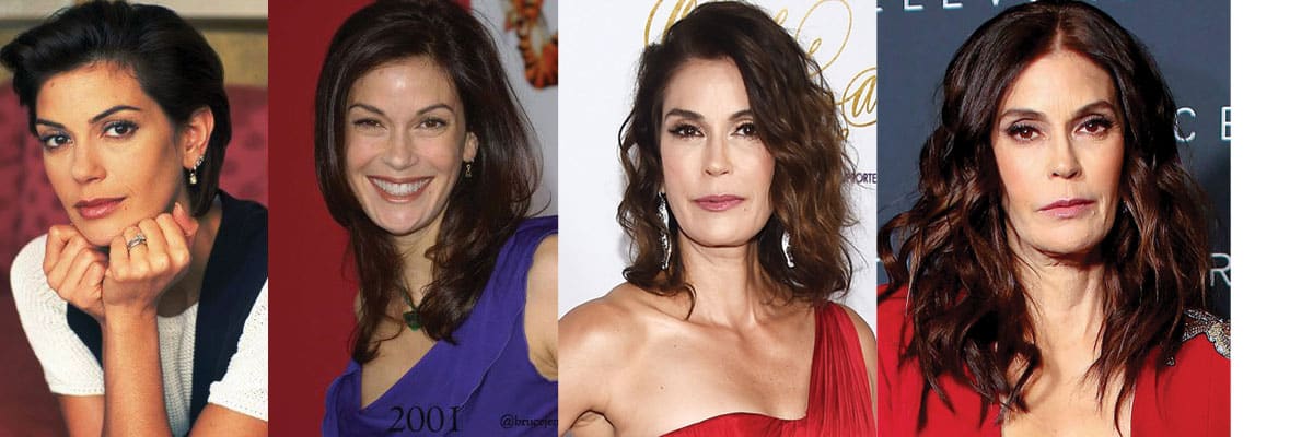 Teri Hatcher Plastic Surgery Before and After 2023