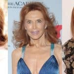 Tina Louise Plastic Surgery