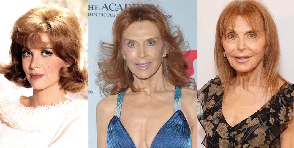 Tina Louise Plastic Surgery Before and After 2023