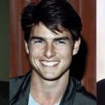 Tom Cruise Plastic Surgery