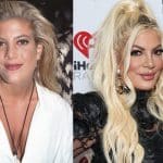 Tori Spelling Plastic Surgery