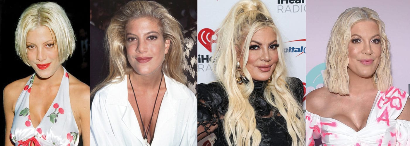Tori Spelling Plastic Surgery Before and After 2023
