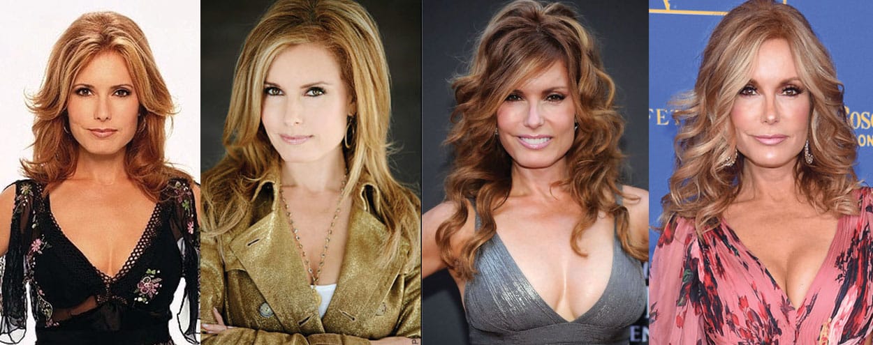 Tracey Bregman Plastic Surgery Before and After 2023