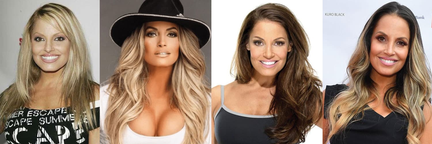 Trish Stratus Plastic Surgery Before and After 2024