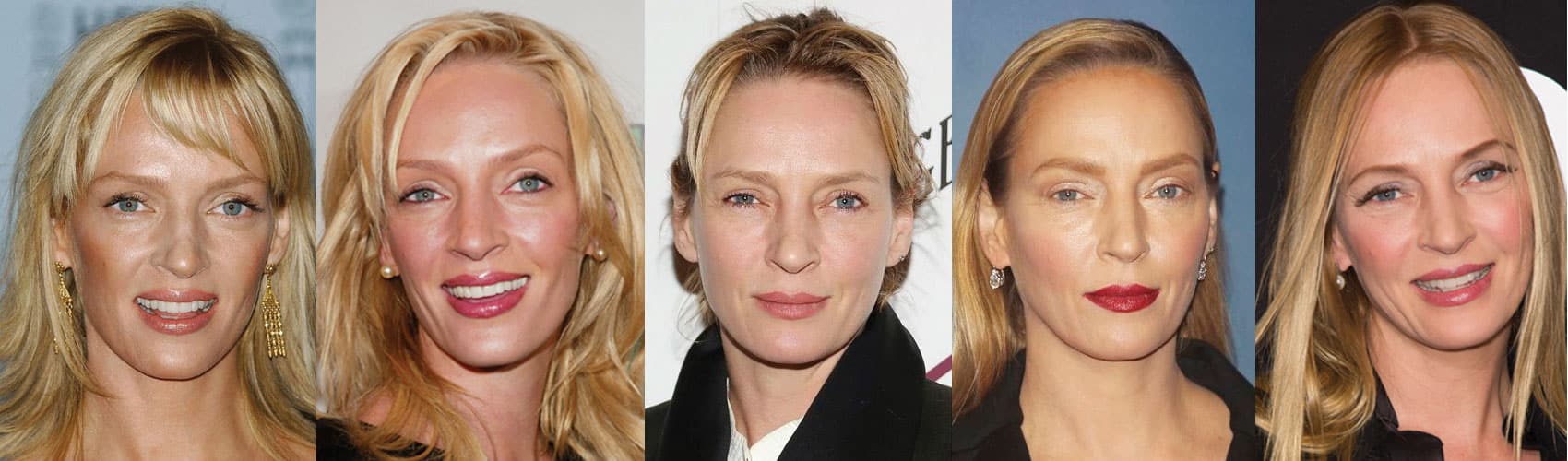 Uma Thurman Plastic Surgery Before and After 2023