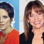 Valerie Harper Plastic Surgery