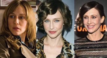 Vera Farmiga Plastic Surgery