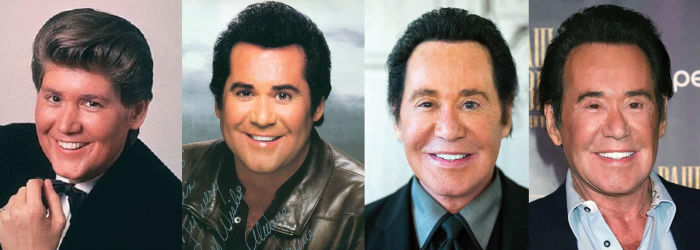 Wayne Newton Plastic Surgery Before and After 2023