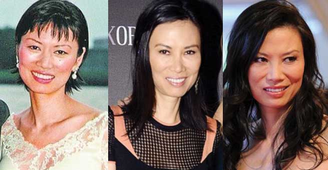 wendi deng plastic surgery