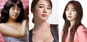 yoon eun hye plastic surgery