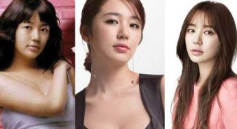 Yoon Eun Hye Plastic Surgery